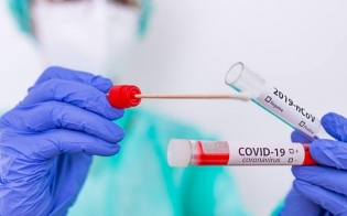     -  COVID-19